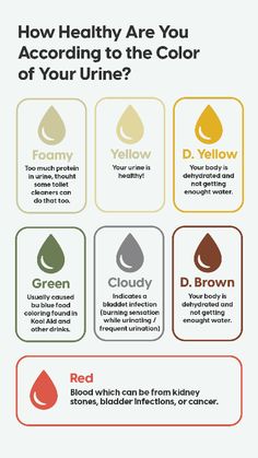 The color of urine is often an indicator of a person's hydration status. Here is a general health assessment based on the color of urine.​ Protein In Urine How To Get Rid Of, Fun Science Worksheets, Fertility Food, Color Of Urine, Urine Color, Lab Week, Health Assessment, Importance Of Water, Fertility Foods