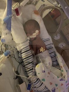 a baby laying in a hospital bed with an iv tube