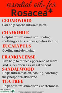 Essential Oils For Headaches, Skin Care Routine Order, Essential Oils Guide, Carrier Oil, Skin Care Steps, Best Essential Oils, Skin Care Brands, Oil Uses, Essential Oil Uses