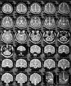 an mri scan shows the various areas of the brain and their corresponding functions in different sections