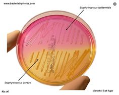 a hand holding a petri dish with labels on the side and labeled in different languages