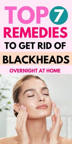 As tempting as it may be, popping pimples can cause more harm than good. Here are the best home remedies to get rid of blackheads: 1. Honey Remedy For Blackheads, Remedies For Blackheads, Nose Blackheads, For Blackheads