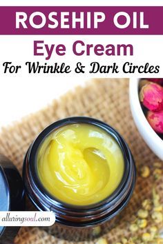 DIY Anti-aging under eye cream helps to reduce wrinkles, removes dark circles and firms skin. It is made with healing ingredients like rosehip oil, shea butter, frankincense oil which makes skin tight and glowing. Boost Collagen, Baking Soda Shampoo, Moisturizer For Oily Skin, Aging Cream