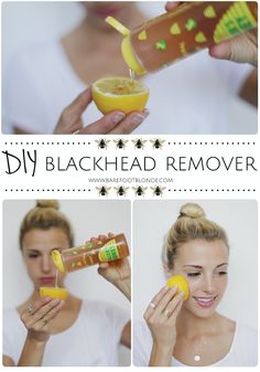 Get rid of blackheads using honey, lemon, and sugar and rubbing on problem areas. // Barefoot Blonde. Blackhead Remover Diy, Rid Of Blackheads, Barefoot Blonde, Get Rid Of Blackheads, Beauty Remedies, Honey Lemon, Homemade Remedies, Beauty Recipe