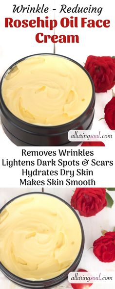 Anti Wrinkle Skin Care, Anti Aging Creme, Skin Care Wrinkles, Anti Wrinkle Cream, Facial Cream, Wrinkle Cream, Best Anti Aging