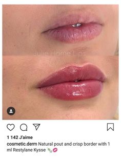 Permanent Makeup Lips, Lips Fillers, Lips Shape