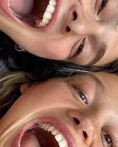 two women with their mouths open showing teeth