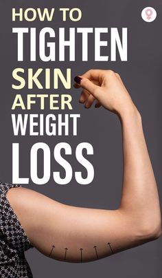 How To Tighten Skin After Weight Loss: You have to be strong physically and mentally to achieve the targeted weight. But if your skin has become loose in the process, worry not. There are ways to tighten skin after weight loss. Your skin may sag and lose elasticity during rapid weight loss as it doesn’t get enough time for its shrinkage. However, the right practices can help. Skin Tightening Remedies, Tighten Loose Skin, Tighten Skin, Saggy Skin, At Home Workout Plan, Loose Skin, Better Health