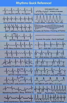 Emt Paramedic Aesthetic, Paramedic Aesthetic, Nurse Knowledge, Paramedic Study, Ekg Rhythms, Cardiac Rehab, Psychotropic Medications