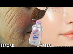 Eye Wrinkles Remedies, Mary Mason, Scar Healing, Wrinkles Remedies Face, Homemade Wrinkle Cream, Wrinkle Remedies, Makeup Tips For Older Women, Face Care Tips, Natural Face Skin Care