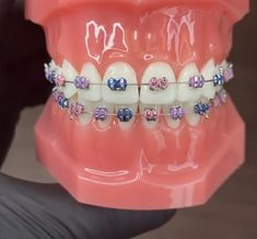 Braces Off Aesthetic, Braces Colour Combinations, Braces Color Combos, Soft Food For Braces, Brace Colors, Braces Colours, Dental Braces Colors, Braces Colors Combinations, Braces Ideas