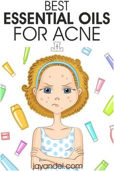 If you want to battle acne with essential oils, check out these top essential oils for acne. Help clear up your skin and get that flawless look that you are dreaming of with the help of essential oils. #essentialoils #acne Face Mapping Acne, Essential Oils For Face, Oils Essential, Body Toxins, Acne Help, Face Mapping