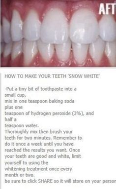 Whiten Teeth At Home, Baking Soda Teeth, Natural Teeth Whitening Remedies, Teeth Whitening Methods, Teeth Whitening Homemade, Teeth Whitening Remedies, Teeth Whitening Diy, Cleaning Advice, Whiten Teeth