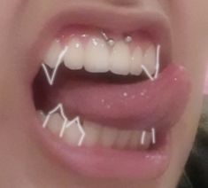 a woman with white teeth and braces on her mouth