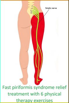 an image of the back of a woman's legs with text that reads, fast priformis syndrome relief treatment with 6 physical therapy exercises