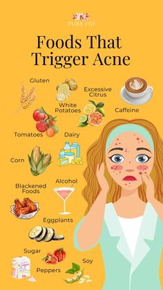 Food alone doesn’t cause acne. Your genes, lifestyle, and what you eat all play a role in the condition. But some foods may make it worse, while others help your skin stay healthy. Scientists need to do more research to know how specific foods really affect the condition. But they have looked at a few possible triggers so far. Read on to learn about how to achieve clear skin by reducing inflammation and more. Foods To Eat To Help With Acne, Acne Foods To Eat, Acne Triggers, Healthy Skin Care Acne, Ginger Smoothie Recipes, Head Acne, Foods For Clear Skin, Food For Glowing Skin, Pineapple Benefits