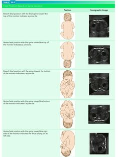 the stages of breast surgery for babies and their mothers, including an infant's stomach