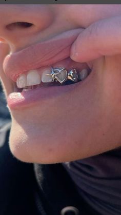 a close up of a person holding their hand near her mouth with the teeth missing