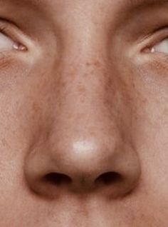 a close up of a person's face with freckles on their eyes