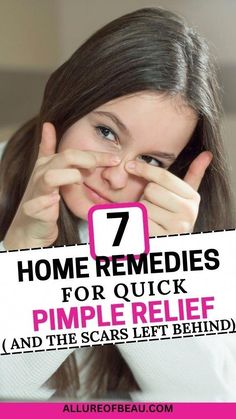 How To Treat Pimples, Treatments For Acne, Acne Overnight