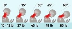 What Tech Neck Syndrome Is, and What Dangers It Hides Text Neck Syndrome, Muscles Of The Neck, Chin Tuck, Text Neck, Tech Neck, Spinal Nerve, Muscle Imbalance, Modern Names