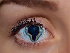 the eye of a child with blue and yellow irises on it's eyes