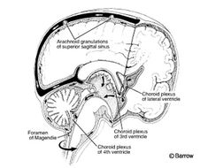 Neuro Assessment, Paranasal Sinuses, Diseases And Disorders, Spinal Fluid, Dysautonomia Pots, Back Health, Blood Pressure Control, Chiari Malformation, Mom Health