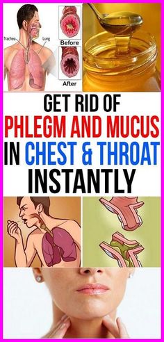 How To Get Rid Of Phlegm And Mucus In Chest & Throat (Instant Result) Mucus In Chest, Phlegm In Throat, Mucus In Throat, Get Rid Of Cough, Getting Rid Of Mucus, Getting Rid Of Phlegm