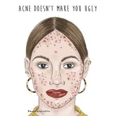 Beauty Standards Quotes, Face Imperfections, Standards Quotes, Lemon Face Mask, Body Positive Quotes, Feeling Low, Night Skin Care Routine, Bare Beauty