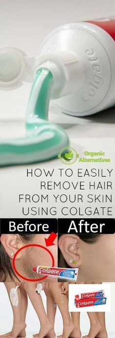 How to Remove Unwanted Hair Using by margaret Mitchell | This newsletter was created with Smore, an online tool for creating beautiful newsletters for educators, nonprofits, businesses and more Baking Soda Hair, Best Facial Hair Removal, Leg Hair Removal, Hair Remove, Baking Soda For Hair, Natural Hair Removal