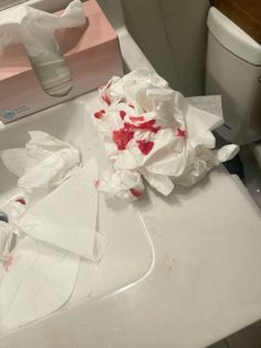 Nosebleeds Fake Photo Tissue, Hand Bleeds Snap, Menstrual Blood Picture In Toilet, Blood Tissue Snapstreaks, Blood Picture Ideas, Nose Bleeds Fake Photo, Menstruation Pictures, Nose Bleeds Aesthetic, Period Blood In Toilet