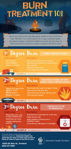 Burn Remedies Hand, Burn Relief Hand, Burn Relief Skin, Burn Wound Care, Safety Hacks, Burn Remedy, Burn Care