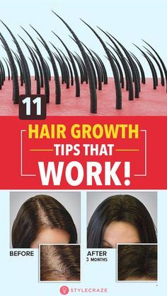 Indian Hair Growth Secrets, Thicker Hair Naturally, Grow Thicker Hair, Get Thicker Hair, Easy Care Hairstyles, Make Hair Grow, Natural Hair Growth Tips, Hair Growth Secrets