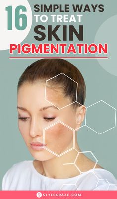 Before we get to the list of home remedies for skin pigmentation, let’s learn about skin pigmentation issues. Recognizing the different types of skin pigmentation and their causes is crucial for choosing the best remedies.