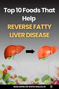 Revitalize Your Liver: 10 Essential Foods to Combat Fatty Liver Disease Unveil the natural power of these foods to rejuvenate your liver health and reverse fatty liver disease. With the right choices, your journey towards a healthier you begins here. Heal Liver