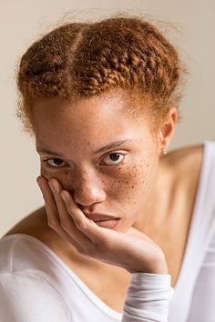 a woman with freckles on her face and hand under her chin looking at the camera