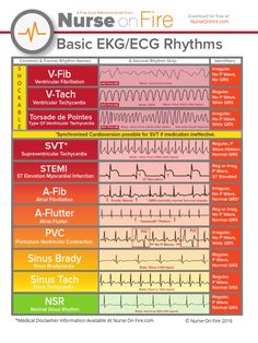 Room Basic, Paramedic School, Nursing Cheat, Nursing Mnemonics, Nursing Student Tips, Medical Student Study, Cardiac Nursing, Nursing School Survival, Critical Care Nursing