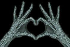 two hands in the shape of a heart with their fingers extended up to form an x - ray