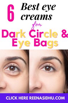 6 Best Eye Creams For Dark Circles Under Eye Cream For Wrinkles, Darkcircles Skincare, Best Korean Eye Cream, Eye Creams For Dark Circles, Korean Eye Cream, Eye Cream For Wrinkles, Best Under Eye Cream, Eye Bag Cream