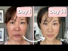 100% EFFECTIVE, FASTEST WAY TO LOOK YOUNGER!! Do it daily for 14 days. - YouTube Face Muscles, Face Fat