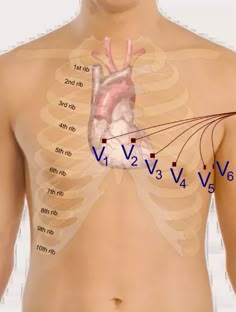 the chest is labeled with an arrow and arrows pointing to the heart, lungs, and ventilators