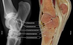 an x - ray view of the right side of a foot with different bones labeled