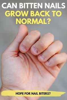 How To Quit Biting Your Nails, Nail Bed Damage Repair, Nail Growth Tips For Nail Biters, Nail Beds Health, How To Grow Nails Naturally, Tips For Nail Biters, Nail Biters Before And After, How To Grow Out Nails Fast, Nail Picking Habit