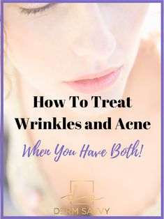 Derm Savvy knows finding a skin care routine that tackles both wrinkles and acne can be difficult.  The answers are easier than you think—if you know how to find the right products! Makeup Wrinkles, Cover Wrinkles, Wrinkle Remedies, Lip Wrinkles, Facial Wrinkles, Anti Aging Wrinkles, Acne Solutions