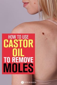 Moles On Face, Narrow Laundry, Remove Moles, Castor Oil Benefits, Skin Moles, Mole Removal, Skin Growths, Beauty Tips For Skin, Oil Benefits