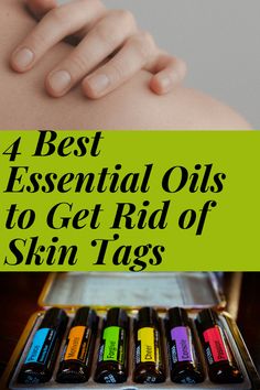 Best essential oils for skin tags. Some of the best oils to get rid of skin tags include tea tree essential oil, frankincense essential oil Oils For Skin Tags, Skin Tags Essential Oils, What Are Skin Tags, Best Essential Oils For Skin, Oregano Essential Oil, Skin Moles