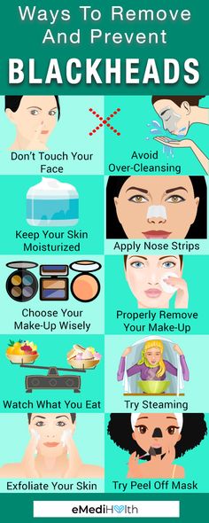 Tips and Remedies and to Get Rid of Blackheads Homemade Scrubs, Blind Pimple, Pimples Under The Skin, Rid Of Blackheads, Homemade Scrub, Home Remedy For Cough, Cold Sores Remedies, Nose Strips, Remove Blackheads