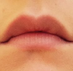 How to make your lips look BIGGER! – LipCulture Lip Injections, Lip Fillers, Your Lips, Lip Plumper, How To Make Your