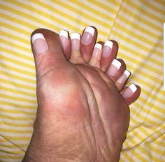 a woman's hand with white and pink manies on her nails, resting against a yellow striped blanket