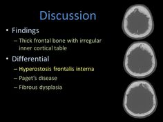 three different types of diaphromis in the body and their corresponding parts are labeled